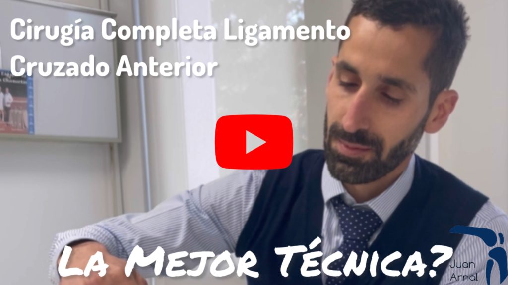 ligamento cruzado anterior, rotura, menisco, madrid, cirujano, rodilla, mejor, adeslas, cuadriceps, hth, isquios, dolor, estabilididad