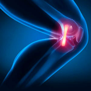 Dolor de rodilla