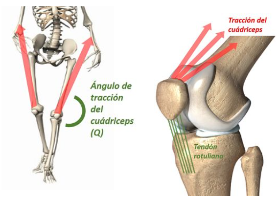 angulo q, valgo rodilla, condromalacia, luxación de rotula, biomecánica,