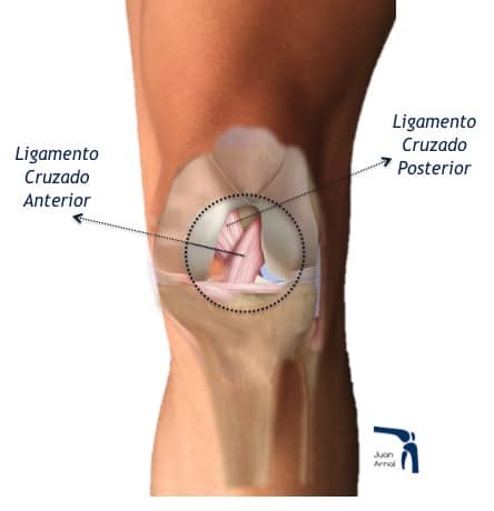 juan arnal, traumatologo, meniscos, rotura menisco, ligamento cruzado anterior, rotura cruzado anterior, ligamento cruzado posterior, plastia cruzado, hth, isquios, semitendinoso, recuperación, cirugía, artroscopia rodilla, tobillo, artrosis rodilla, adeslas, asisa, cirujano rodilla, traumatologo deportivo