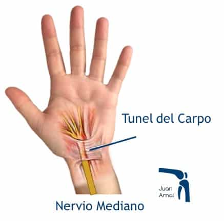 Túnel del Carpo