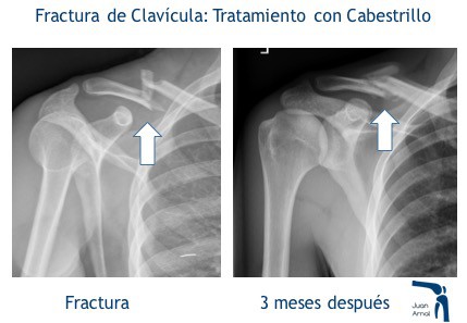 juan arnal, traumatologo, madrid, rotura, fractura, cirugia, deporte, recuperacion, operacion,