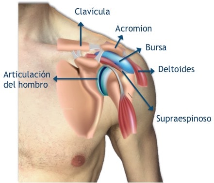 Pinzamiento de Hombro
