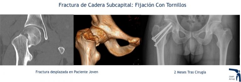 juan arnal, traumatologo, madrid, rotura, fractura, cirugia, deporte, recuperacion, operacion,