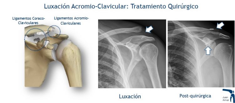 juan arnal, traumatologo, madrid, rotura, fractura, cirugia, deporte, recuperacion, operacion,