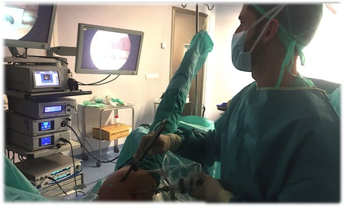 artroscopia hombro, manguito rotador, tendinitis calcificante, tendinitis, supraespinoso, bursitis hombro, acromion, sindrome, rotadores, tendon hombro, tendinitis, tratamiento , cirugía, adeslas, privado, madrid, juan arnal, traumatologo,