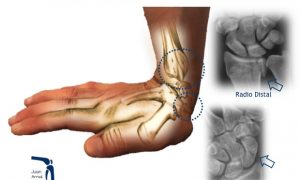juan arnal, traumatologo, madrid, rotura, fractura, cirugia, deporte, recuperacion, operacion,