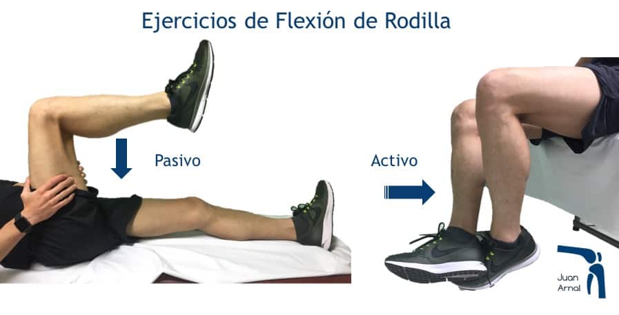movilidad, rodilla, cirugia, ligamento cruzado, recuperación, juan arnal, traumatologo, madrid, adeslas, privado,