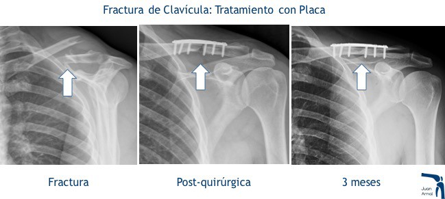 juan arnal, traumatologo, madrid, rotura, fractura, cirugia, deporte, recuperacion, operacion,