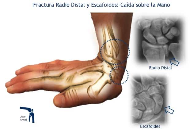 juan arnal, traumatologo, madrid, rotura, fractura, cirugia, deporte, recuperacion, operacion,