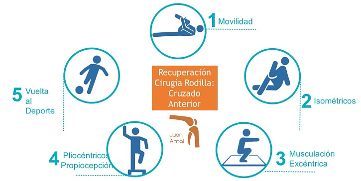 juan arnal, cirugia rodilla, menisco, ligamento cruzado anterior, recuperación plastia cruzado, ejercicios cirugia rodilla, ligamento cruzado anterior, movilidad, rodilla, cirugia, ligamento cruzado, recuperación, juan arnal, traumatologo, madrid, adeslas, privado,